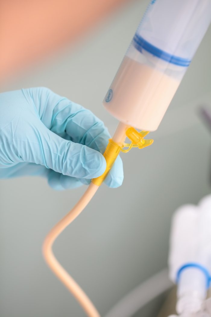 Nutrition artificielle : préparation du matériel